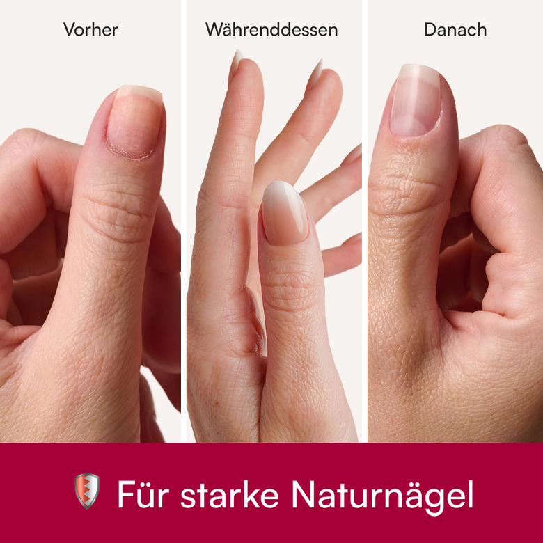 Keine Schäden am Naturnagel