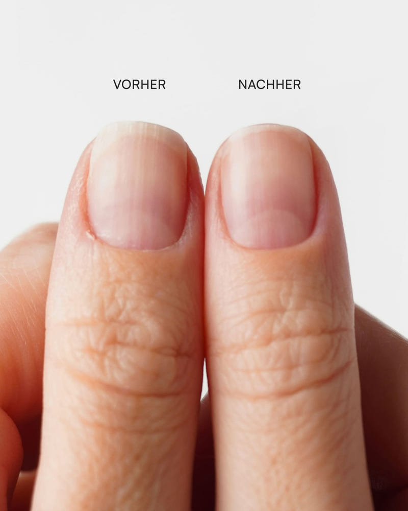 Nagelhautzange