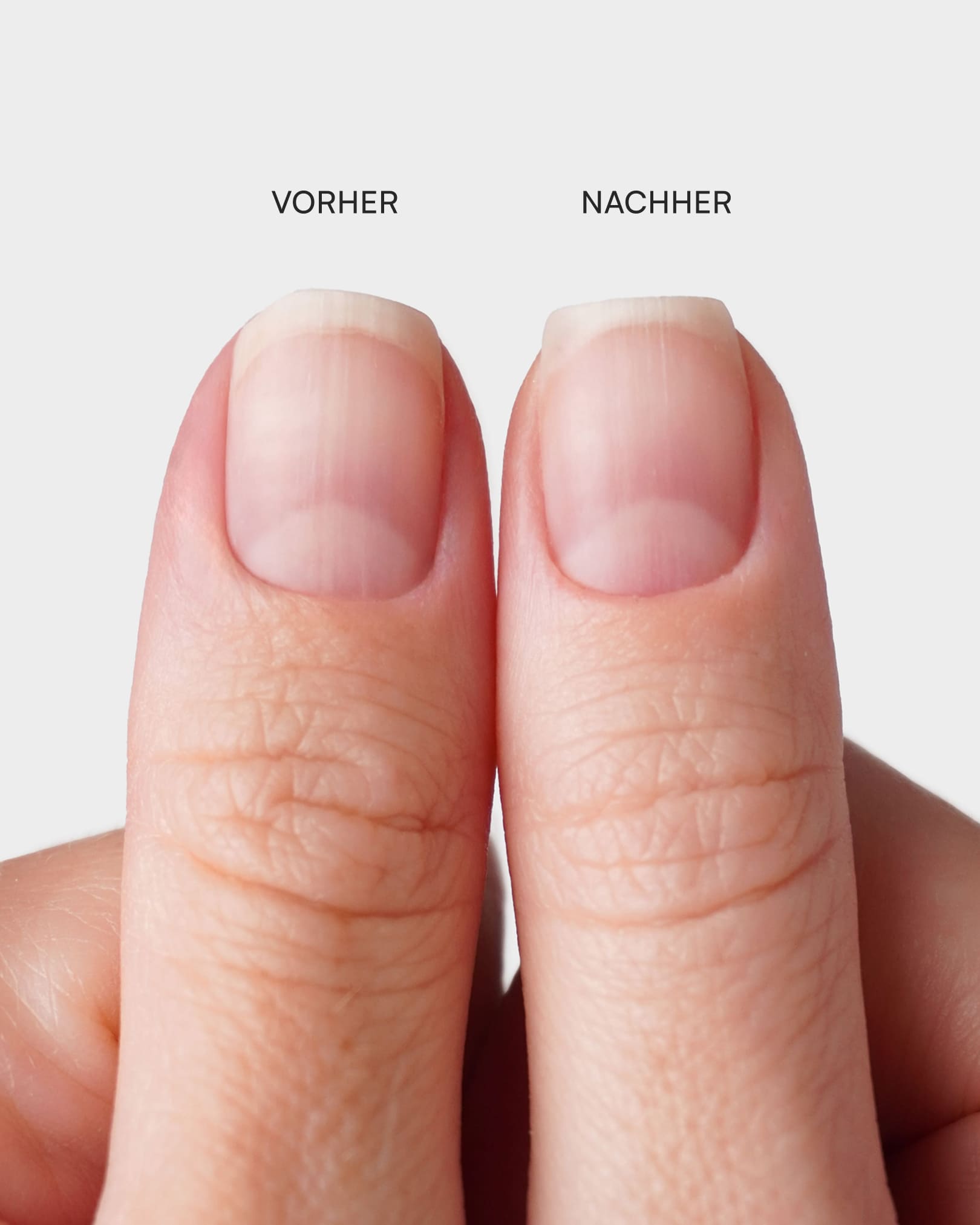 Premium Halbmond Feilen Set